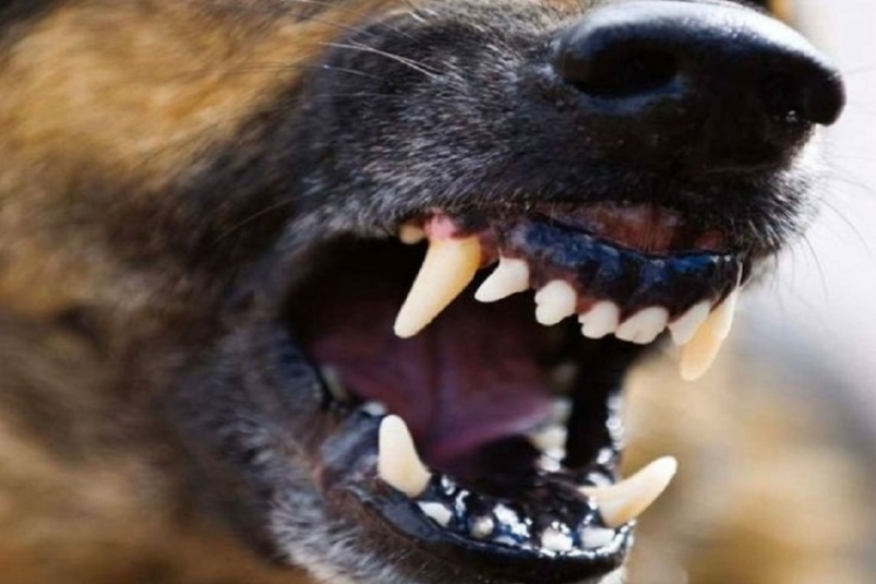 В Магадане расследуют нападение стаи собак на ребенка