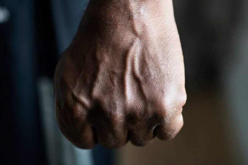 В Магадане установлен несовершеннолетний, причинивший телесные повреждения мужчине